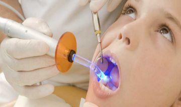 ابداع ماده پُر کردن دندان‌ با ماندگاری دو برابری