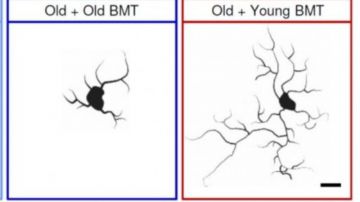 پیوند مغز استخوان برای جلوگیری از افول توانایی شناختی و حافظه