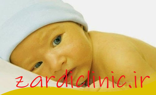 زردی نوزاد و سوالات پیرامون آن